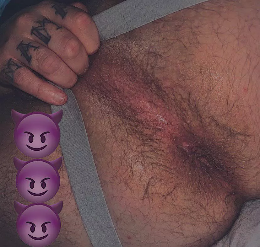 look at my hairy ass 🍑 posted by Slow-Emu-2528
