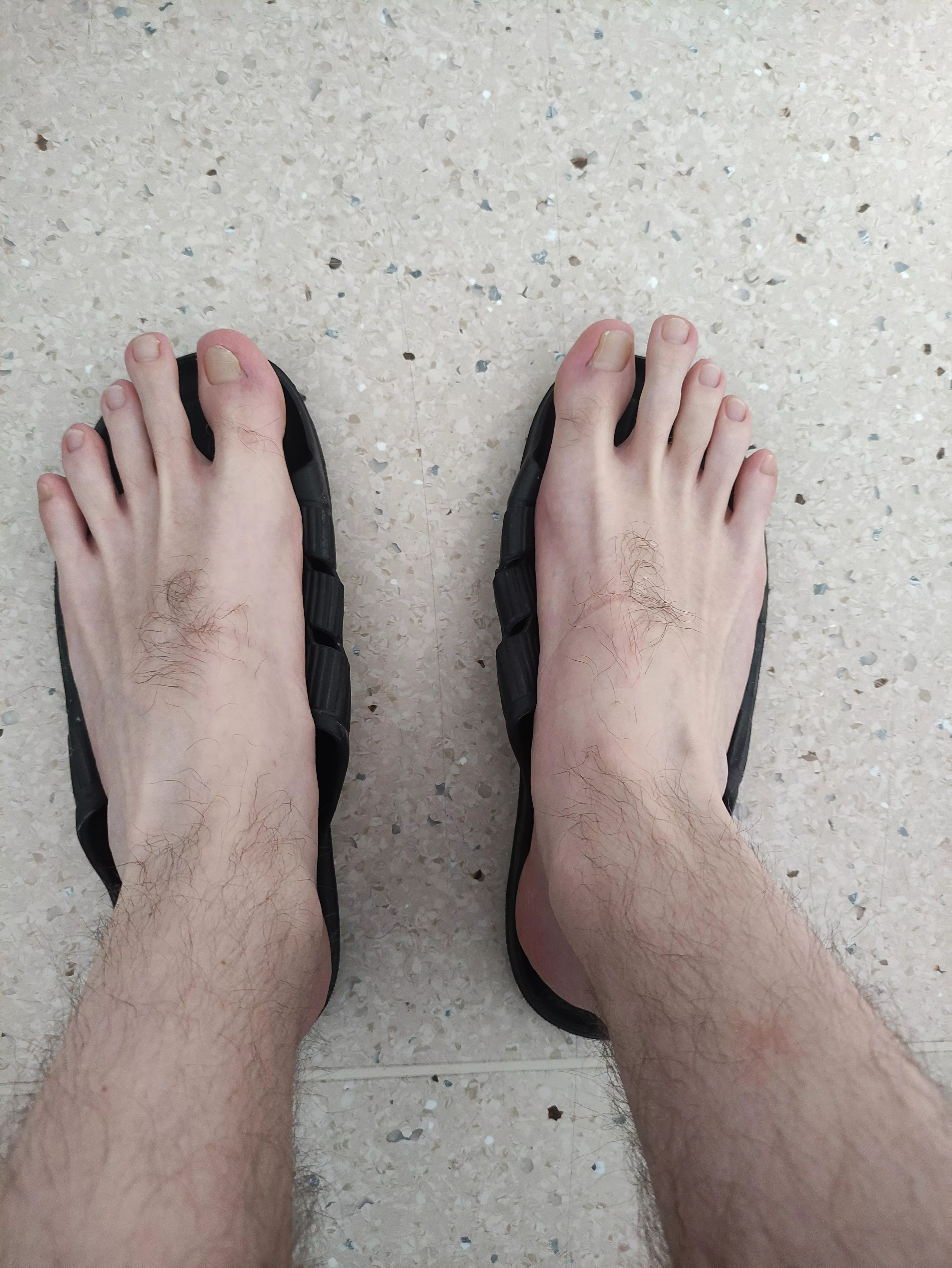 I have pretty hairy feet. What do you think about it? 😄 posted by Then-Mechanic-3092