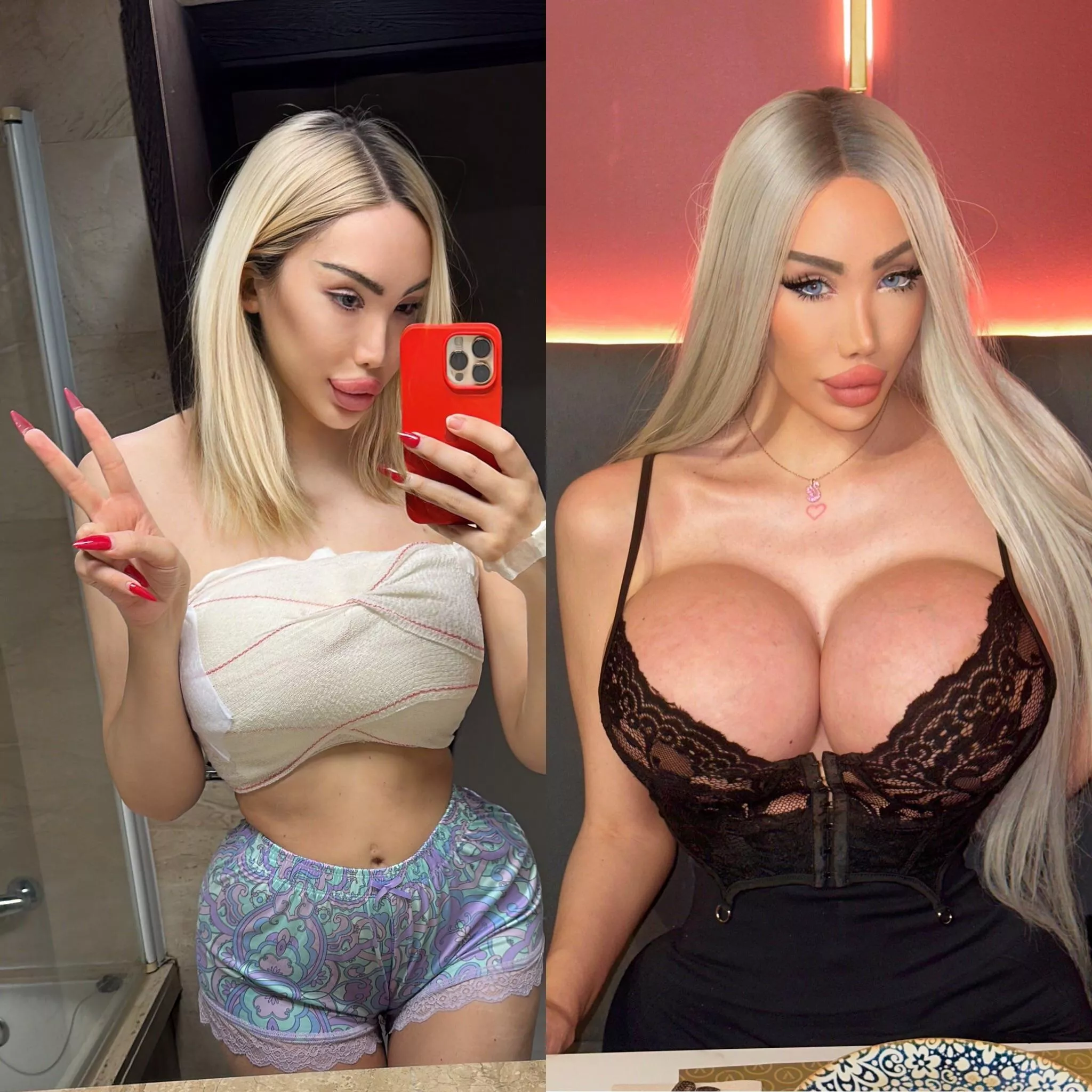 One year ago after having to replace my expanders and going back to 1100cc. I’m now bigger than ever with my 2500ccs. I wanted an implant with more projection and I got them  posted by Luxury_Plastic_Doll