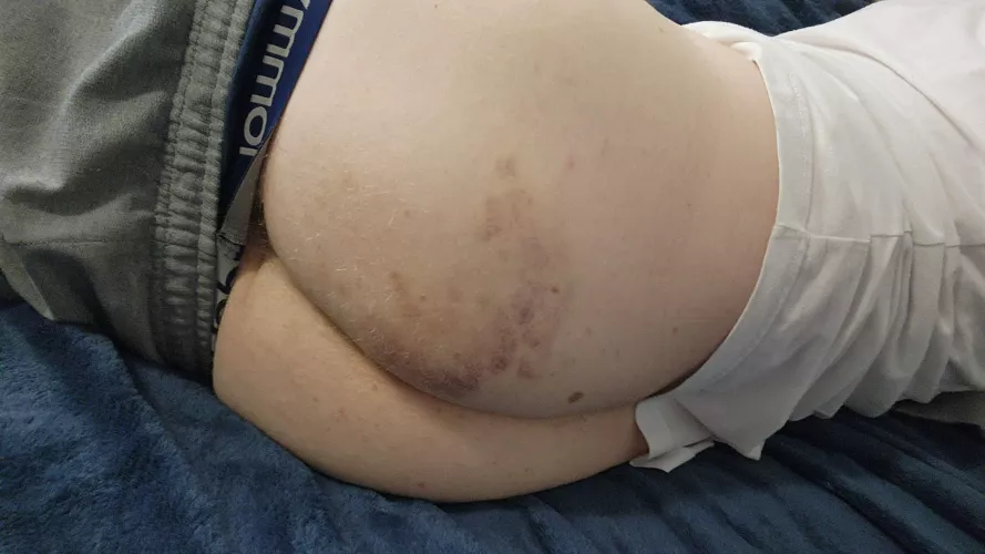 Request for my first bruised booty from my keyholder and got exactly what I asked for by cageandcollar
