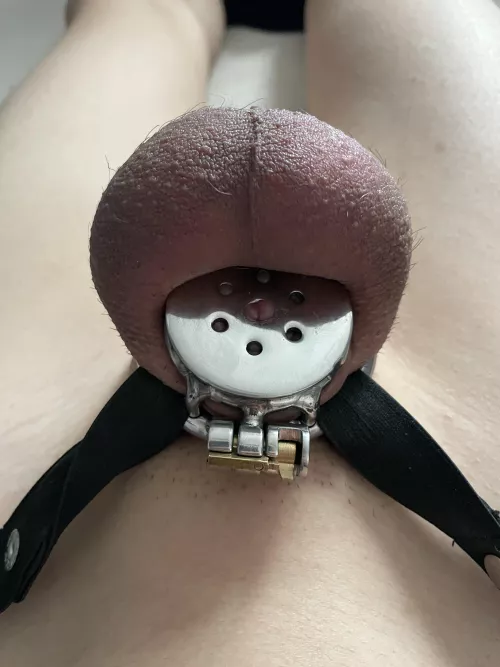 What are the risks of blood restriction? by Huge-Target3583