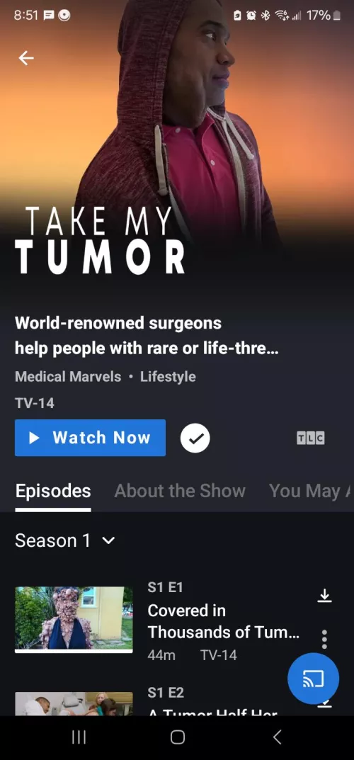 TAKE my Tumor TV Show TLC by Puzzleheaded_Ad9492