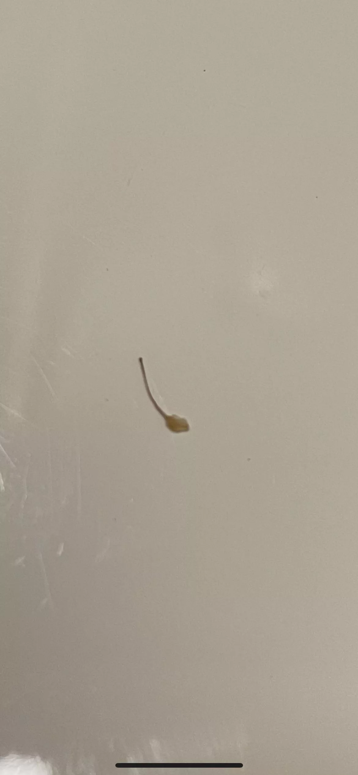 Ingrown hair after wax  posted by EmotionalAd3820