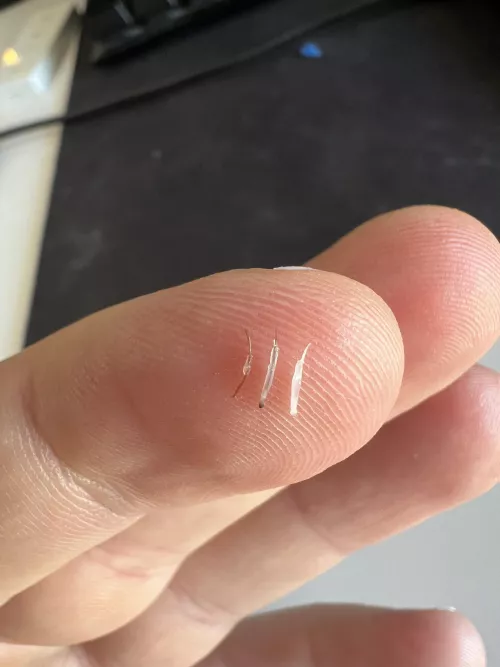 Normal hair vs painful hairs by Melodic-Award3991