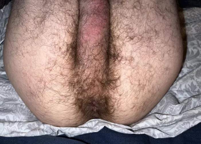 More hairy twink hole. 😅 by shh-itsasecret-