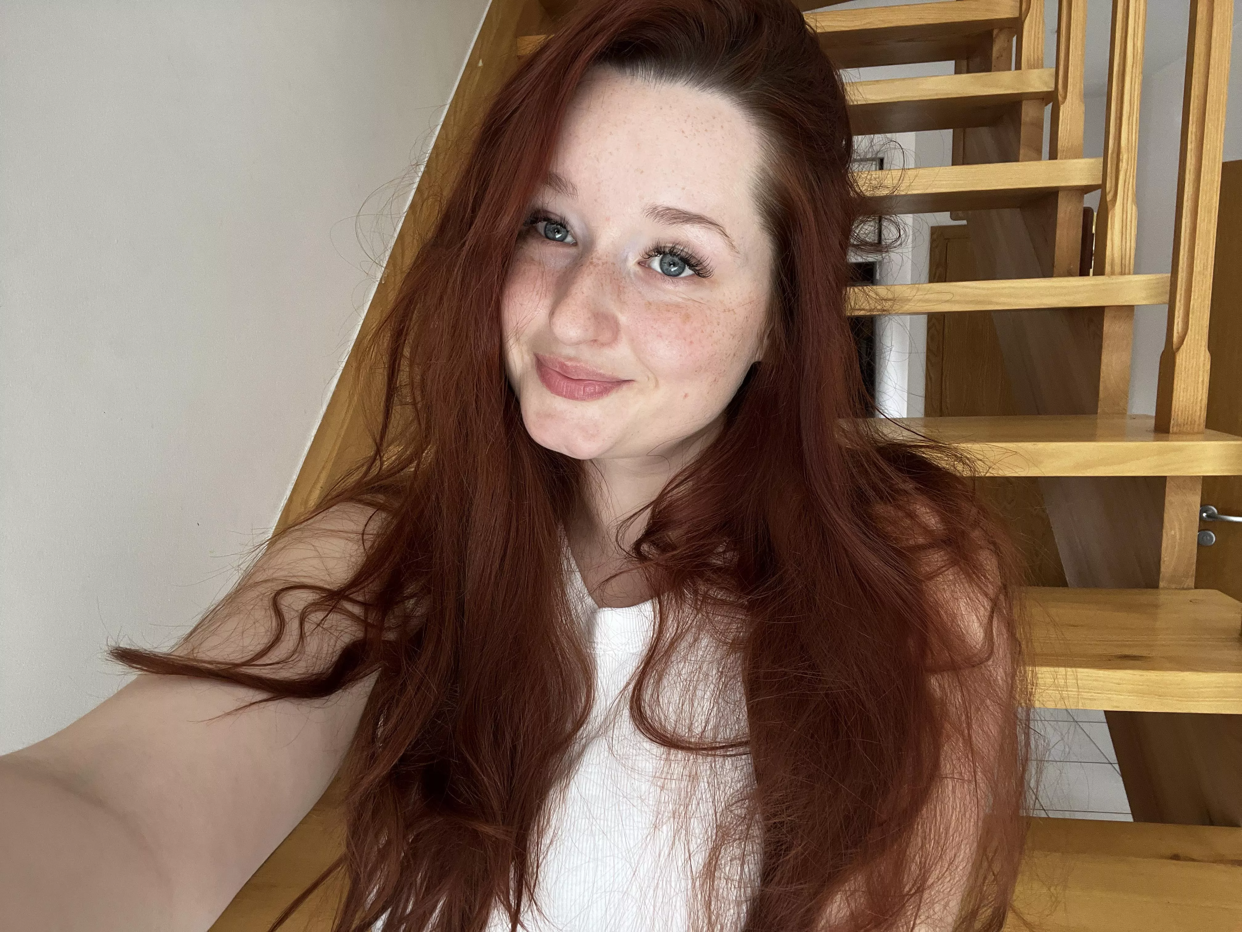 I love my freckles and I hope you like them too! [irtr] posted by eastern_eu_baby