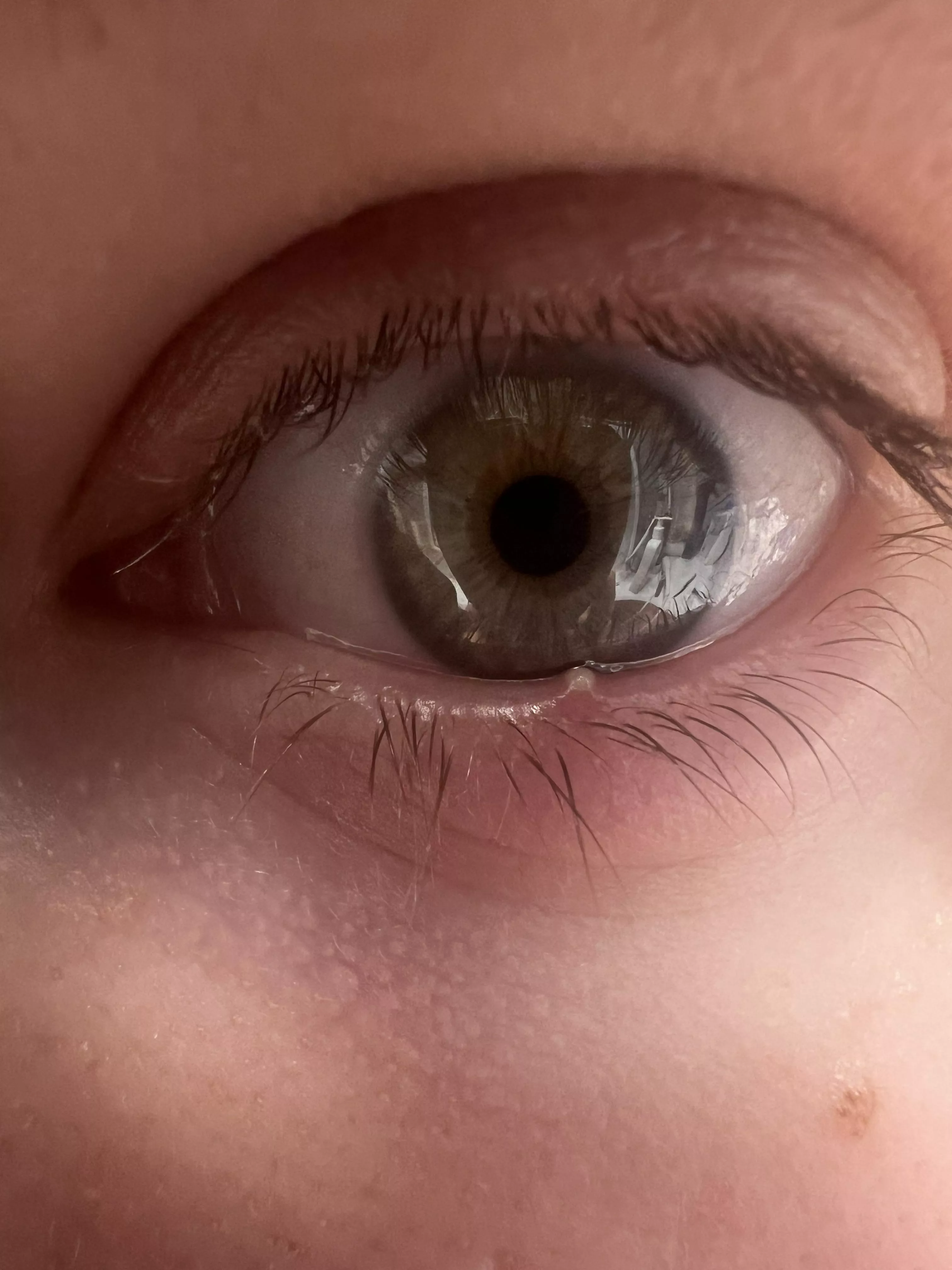 Painful stye lower eyelid posted by New-Huckleberry-7129