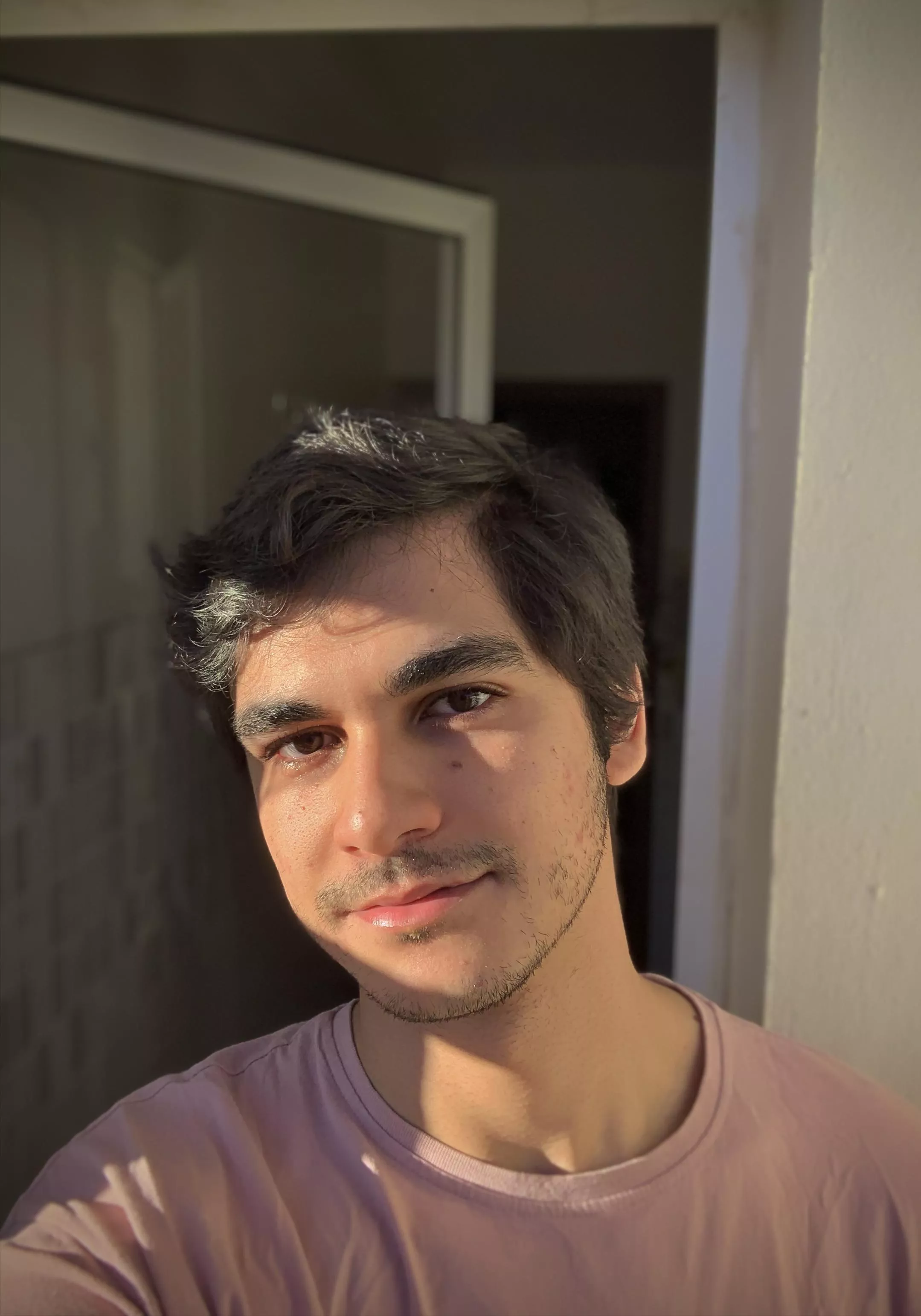 Sun slapped and allergic rhinitis! ☀️🤧 posted by Autoimmunemadness