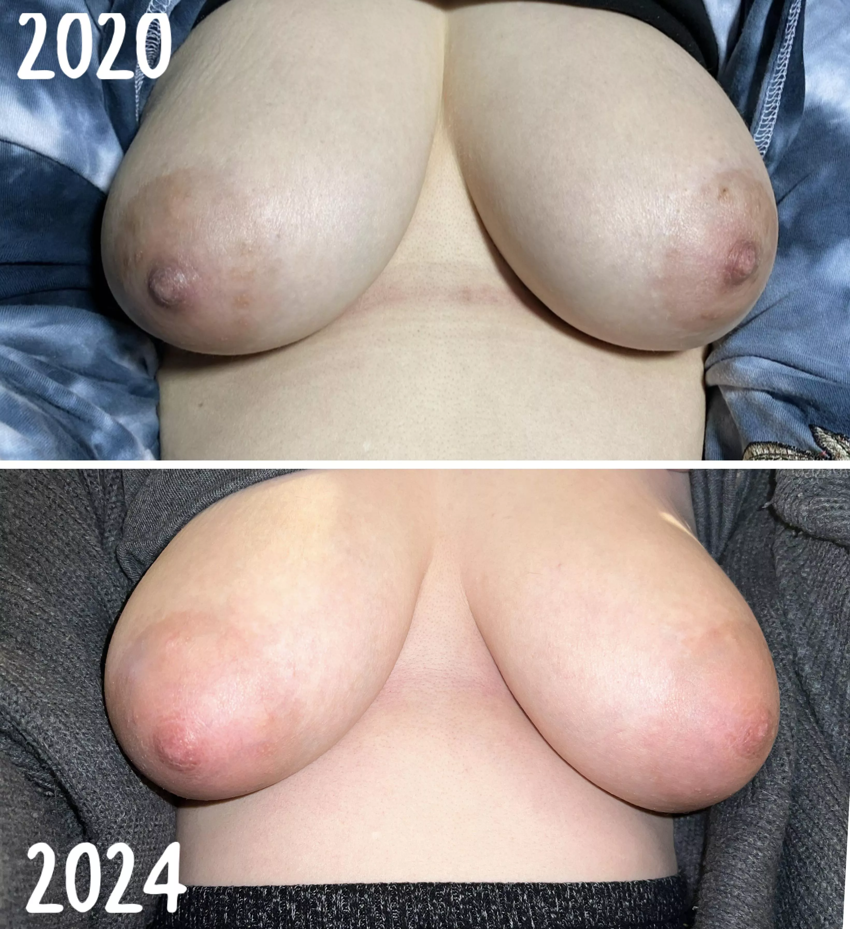 have my areolas gotten bigger? 🧐 posted by sex_bunni420