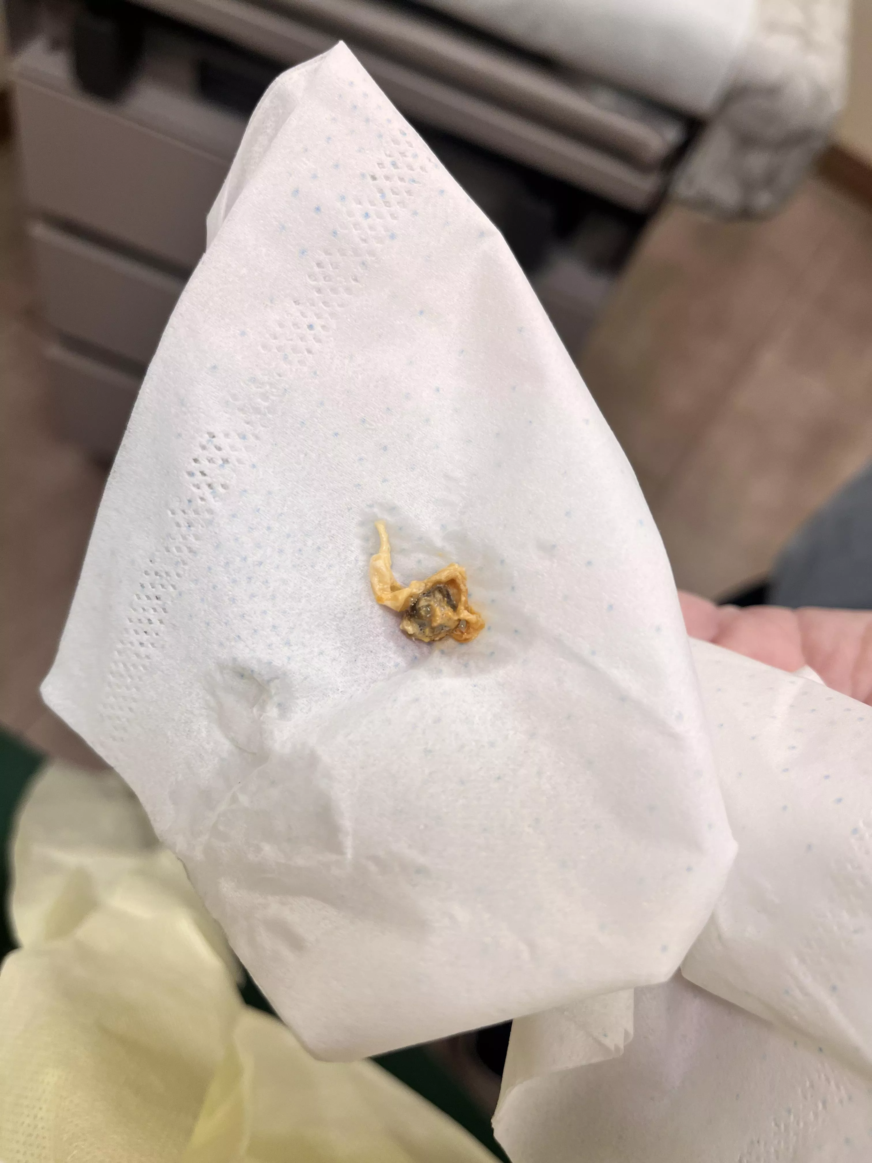 went to dr for ear infection - couldn’t see ear drum because it was blocked by this beast posted by No_Coat_5794