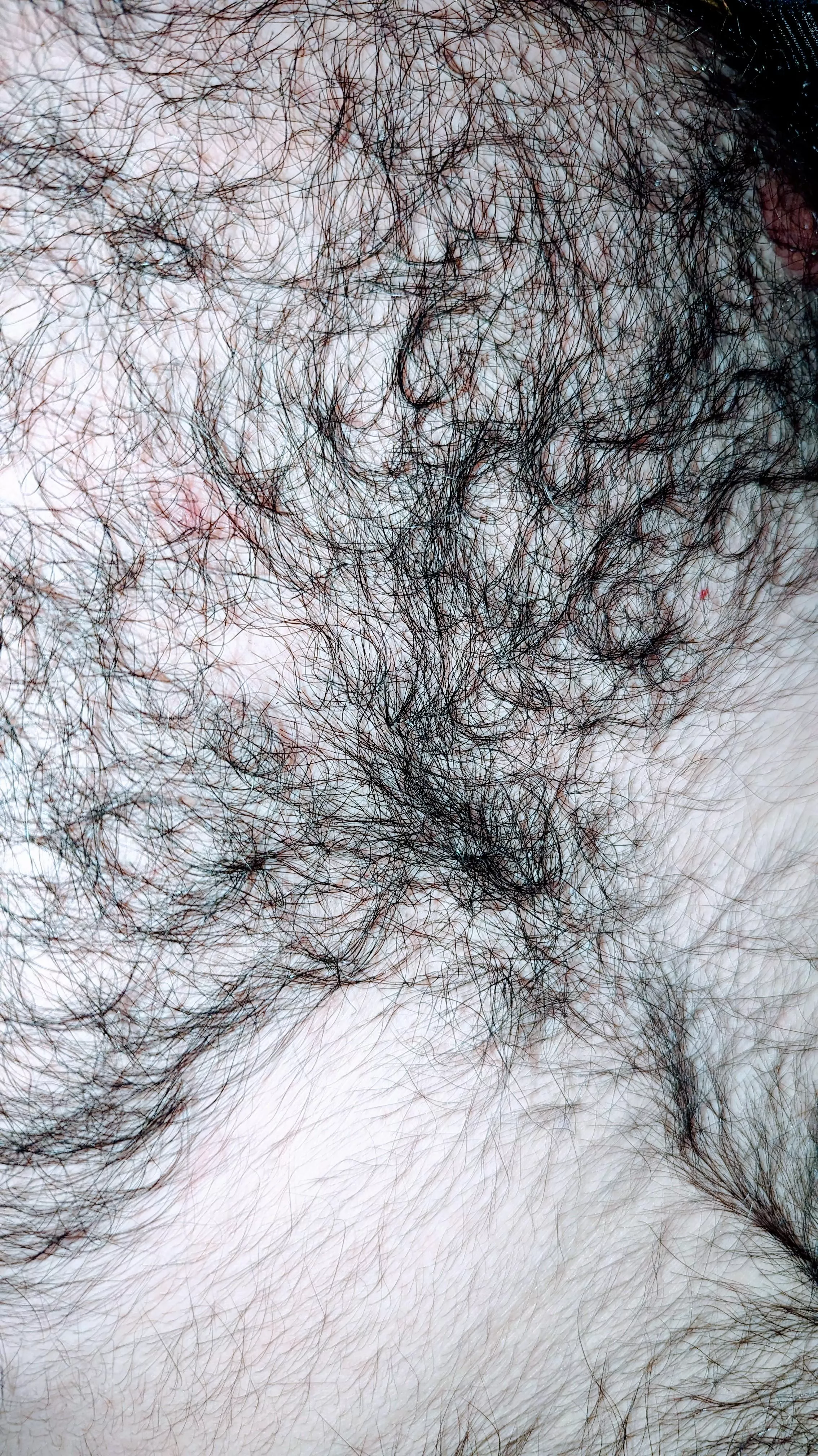 A bit curly  posted by Anxious_Ananas_643