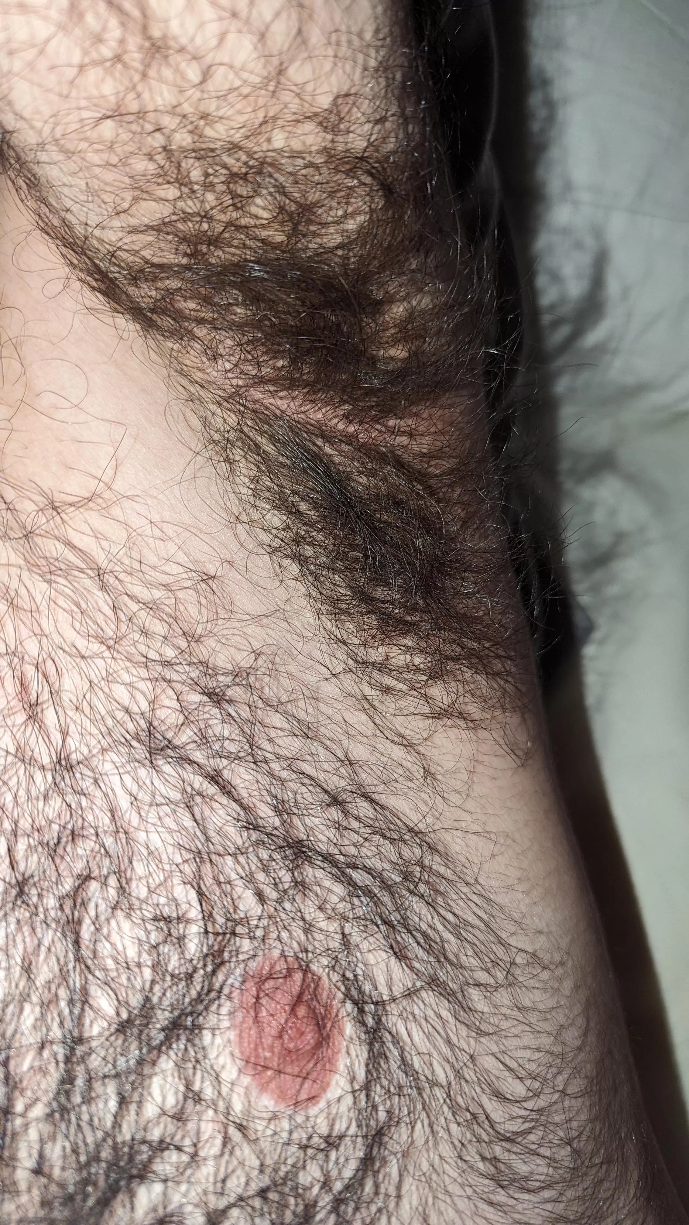 Always the same armpits. posted by Anxious_Ananas_643