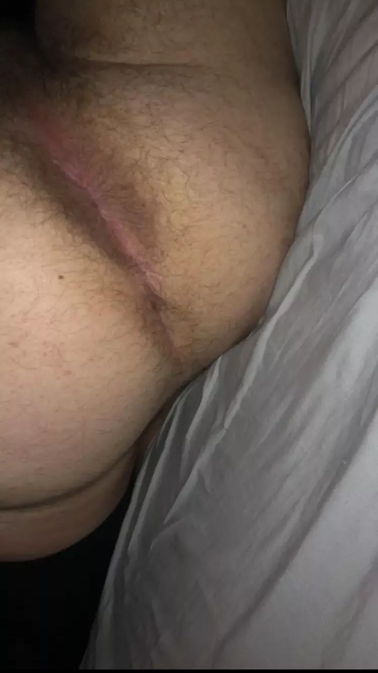 How’s my hole look posted by Imaginary-Ad-1310
