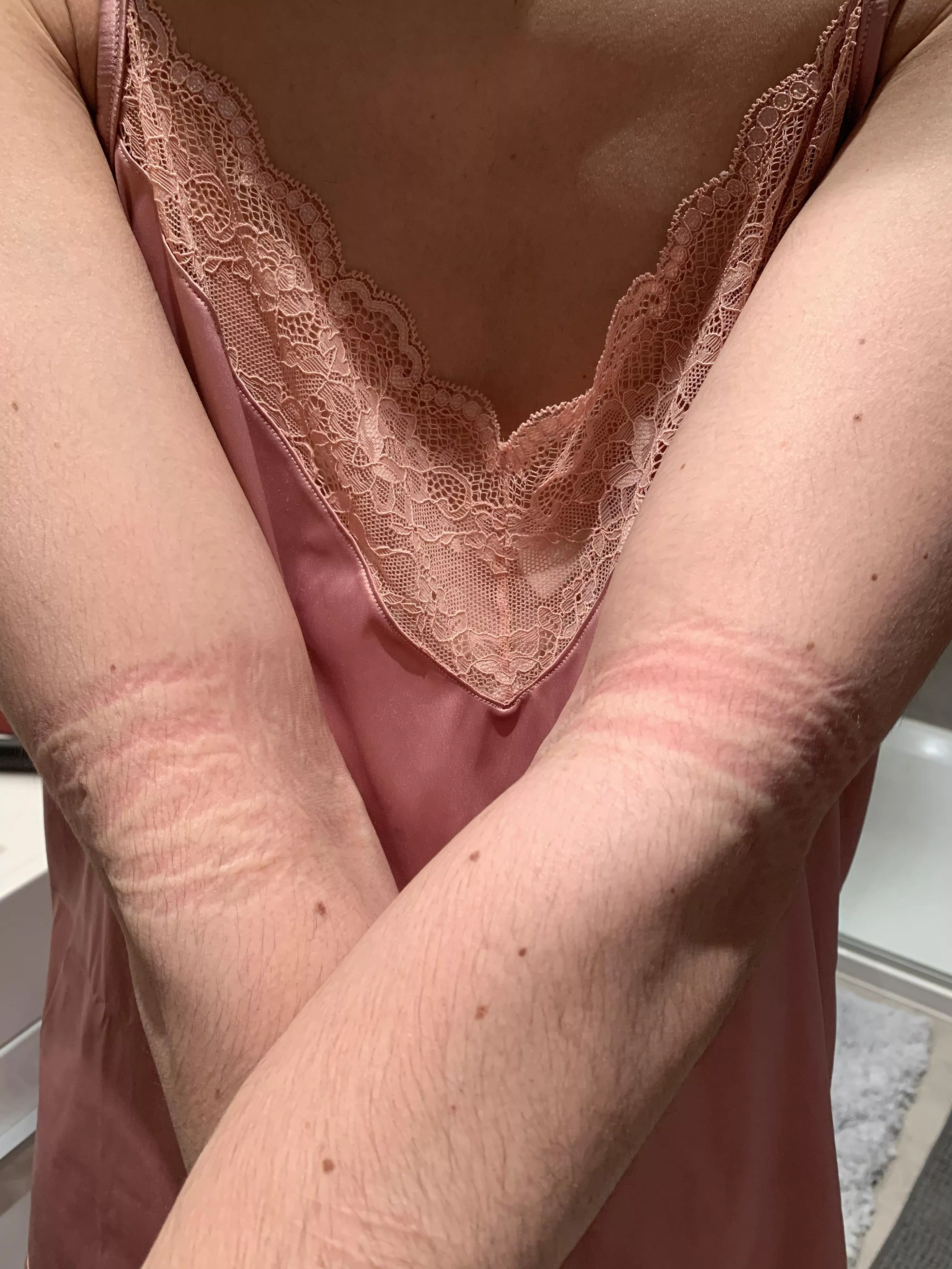 Would you want these marks 24/7? I would ^^ posted by BigLilyPond