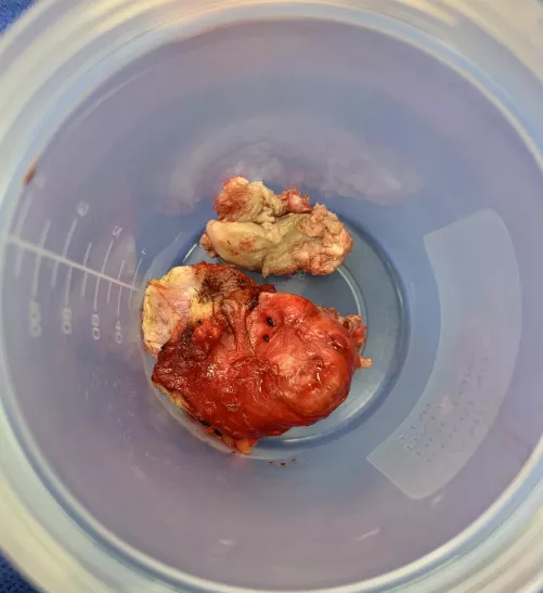 Forbidden Pop removed by ExiledCanuck