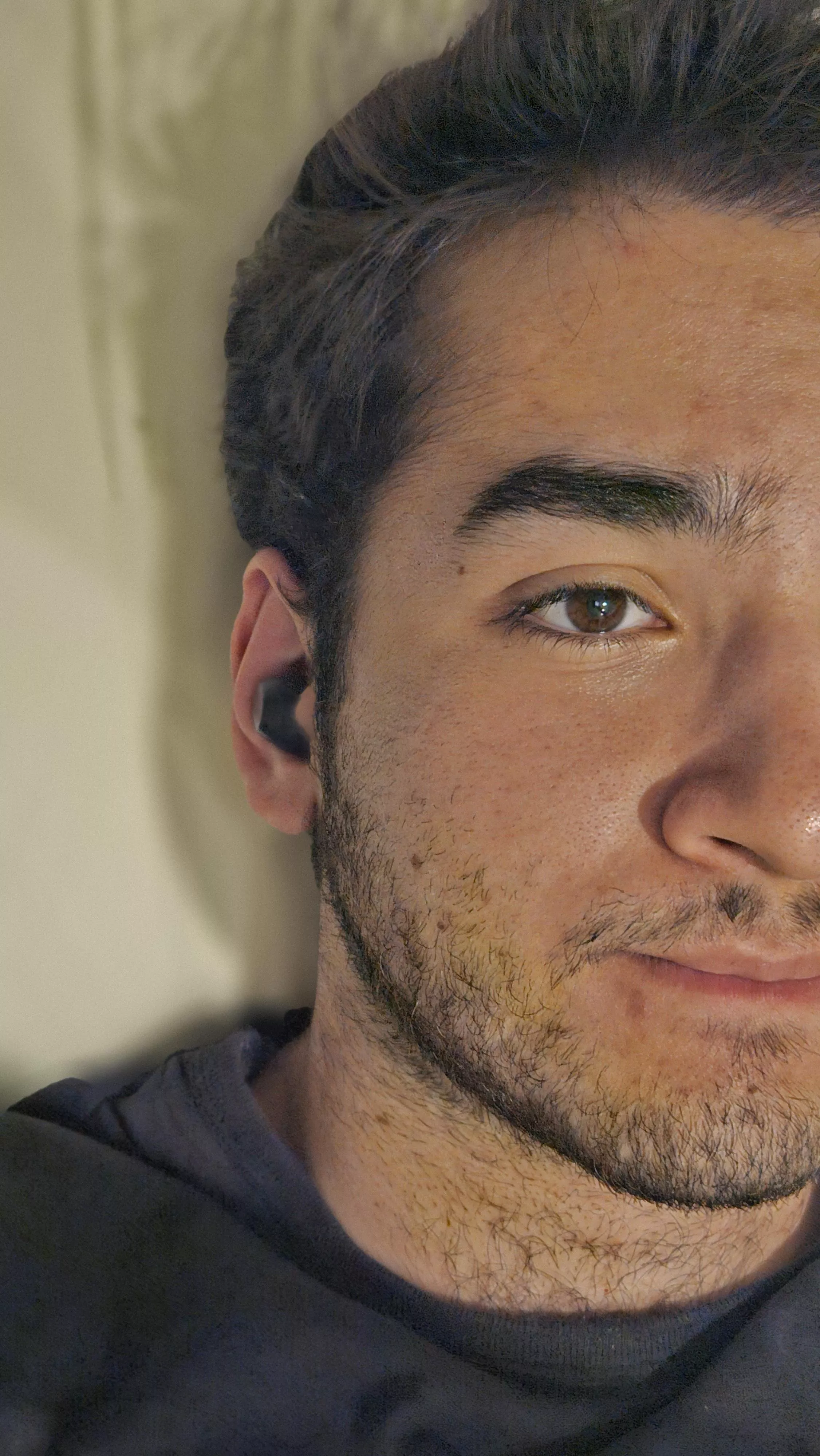 Here is a close up of my face with all of its flaws 😆 posted by randomuser73822