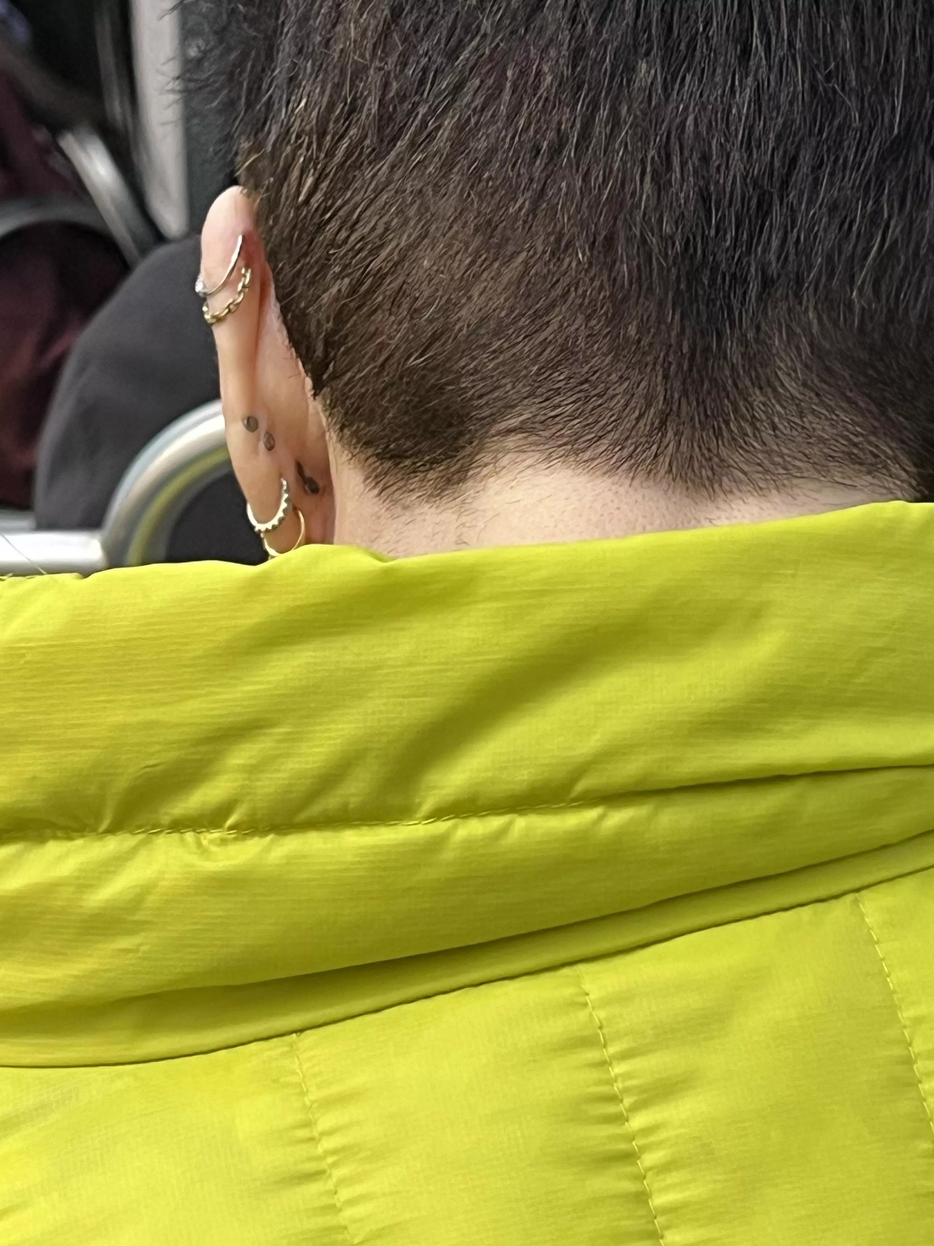 Thought these were blackheads at first, super disappointed posted by LJayEsq