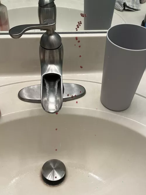 i popped a really deep cyst/abscess on my biking line and it exploded by endofthefkingworld