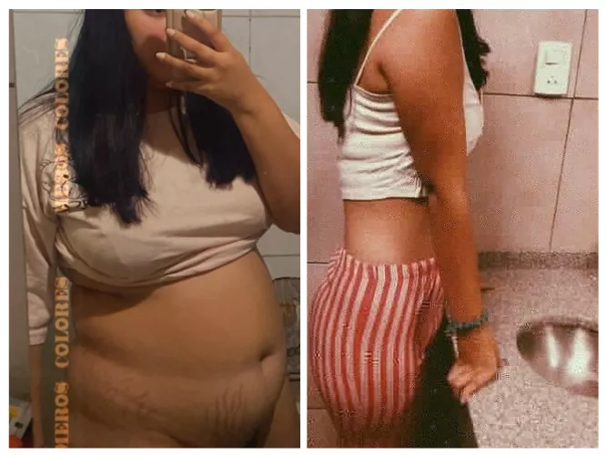 My before and after starting to eat! I love my belly argentina 20 years by lumpaschubby