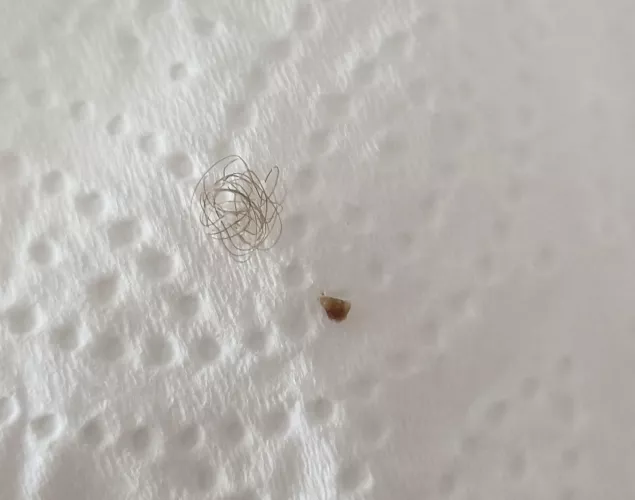 Medication made me come out in spots. Missus decided to pop some old ones whilst she was at it and this came out by Proven_Accident