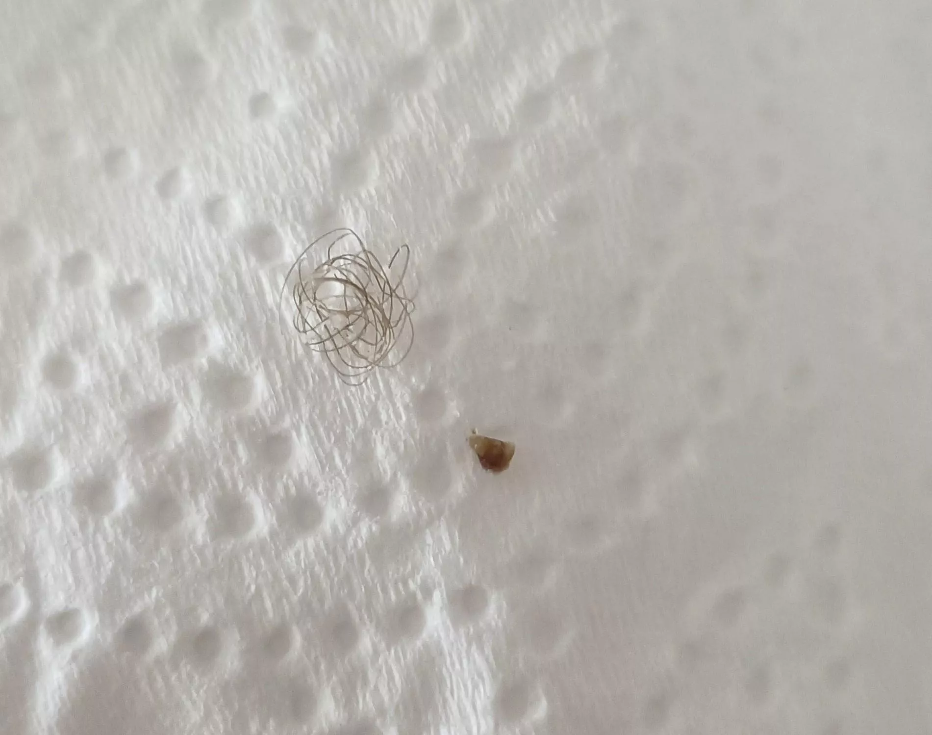 Medication made me come out in spots. Missus decided to pop some old ones whilst she was at it and this came out posted by Proven_Accident