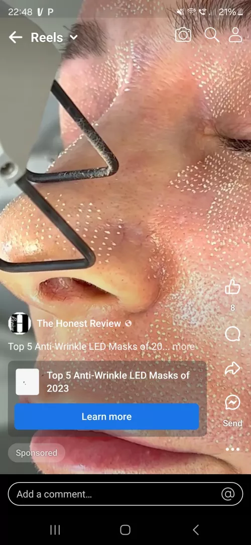 What is going on here? Is it a tool? Are those white heads?  by CanWeNapPlease