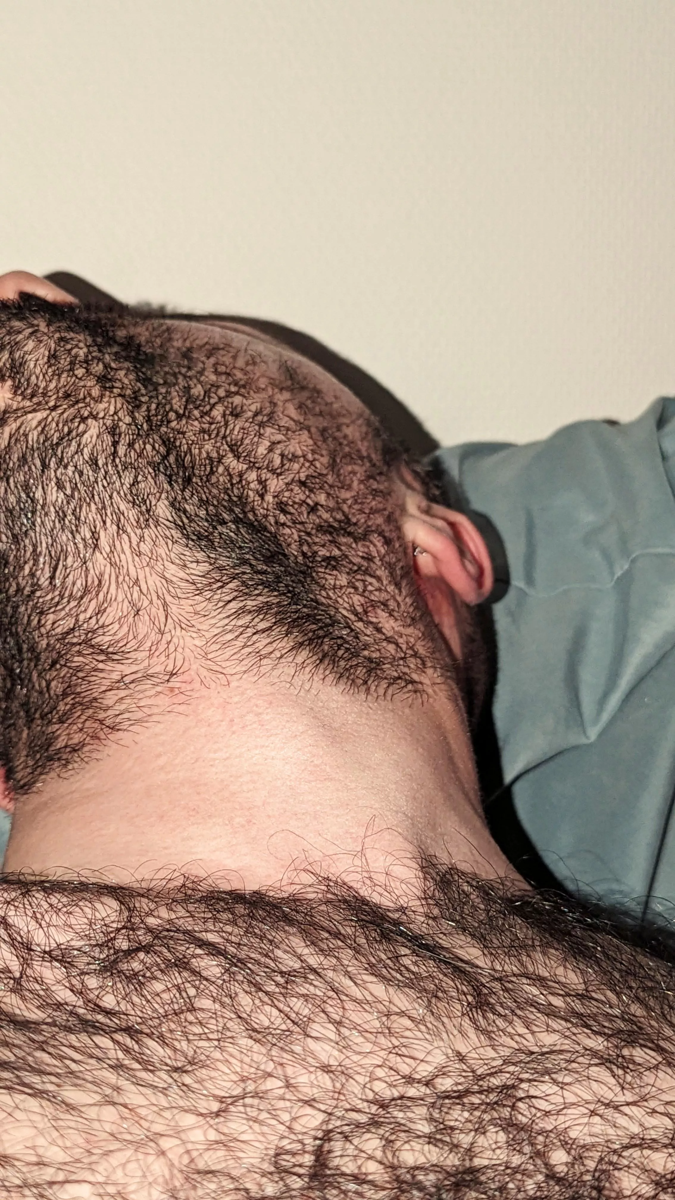 Insanely beardy. Too. posted by Anxious_Ananas_643