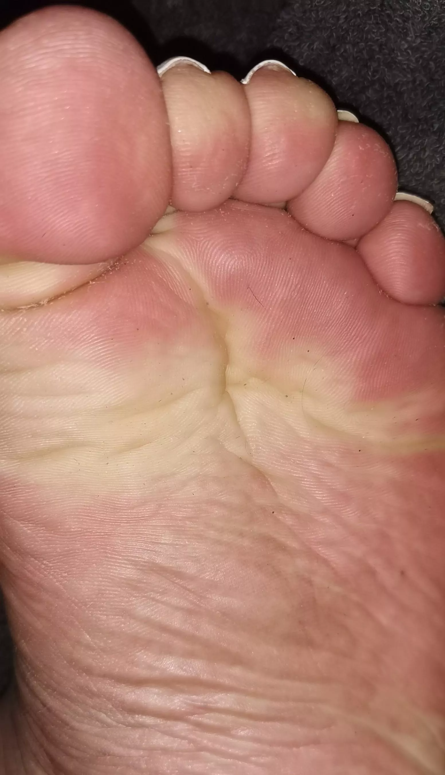 Do you like my wrinkles? 😁 posted by Elegant-Morning-8580