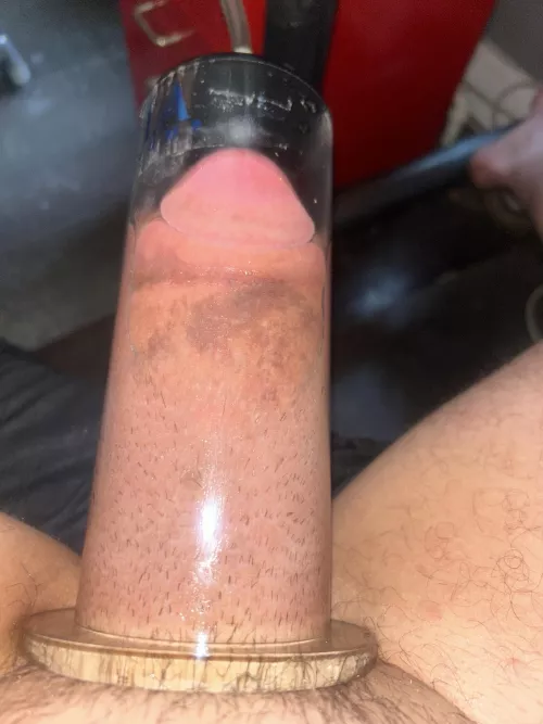 Full package  by euphoruc-acid