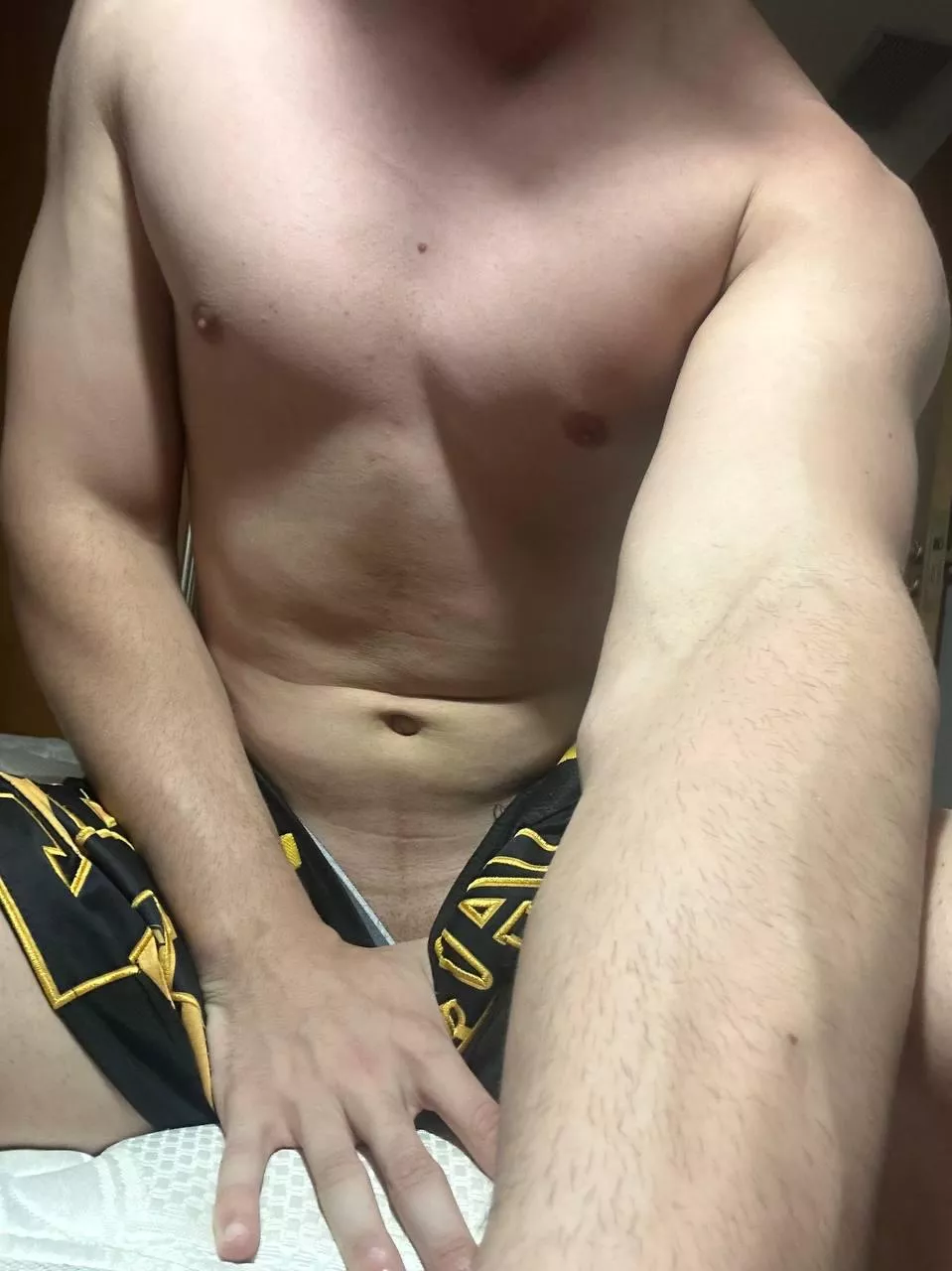 Veins not this visible is still valid? posted by itscameron_