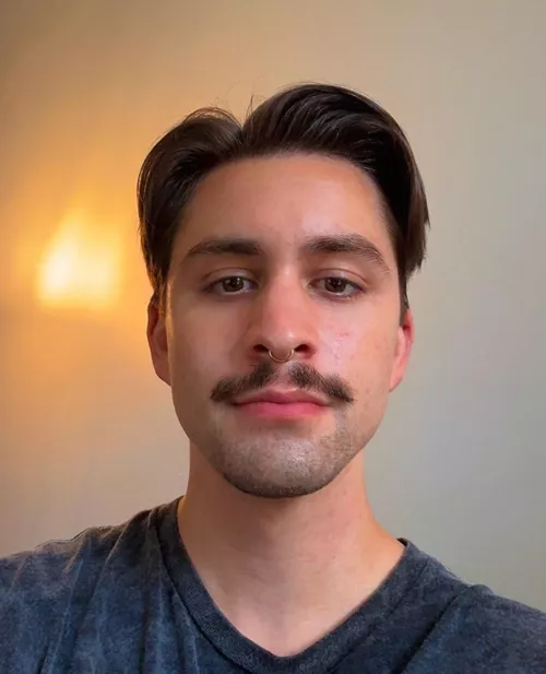 skin starting to clear up (or maybe it’s just the dim lighting!) by seaelm