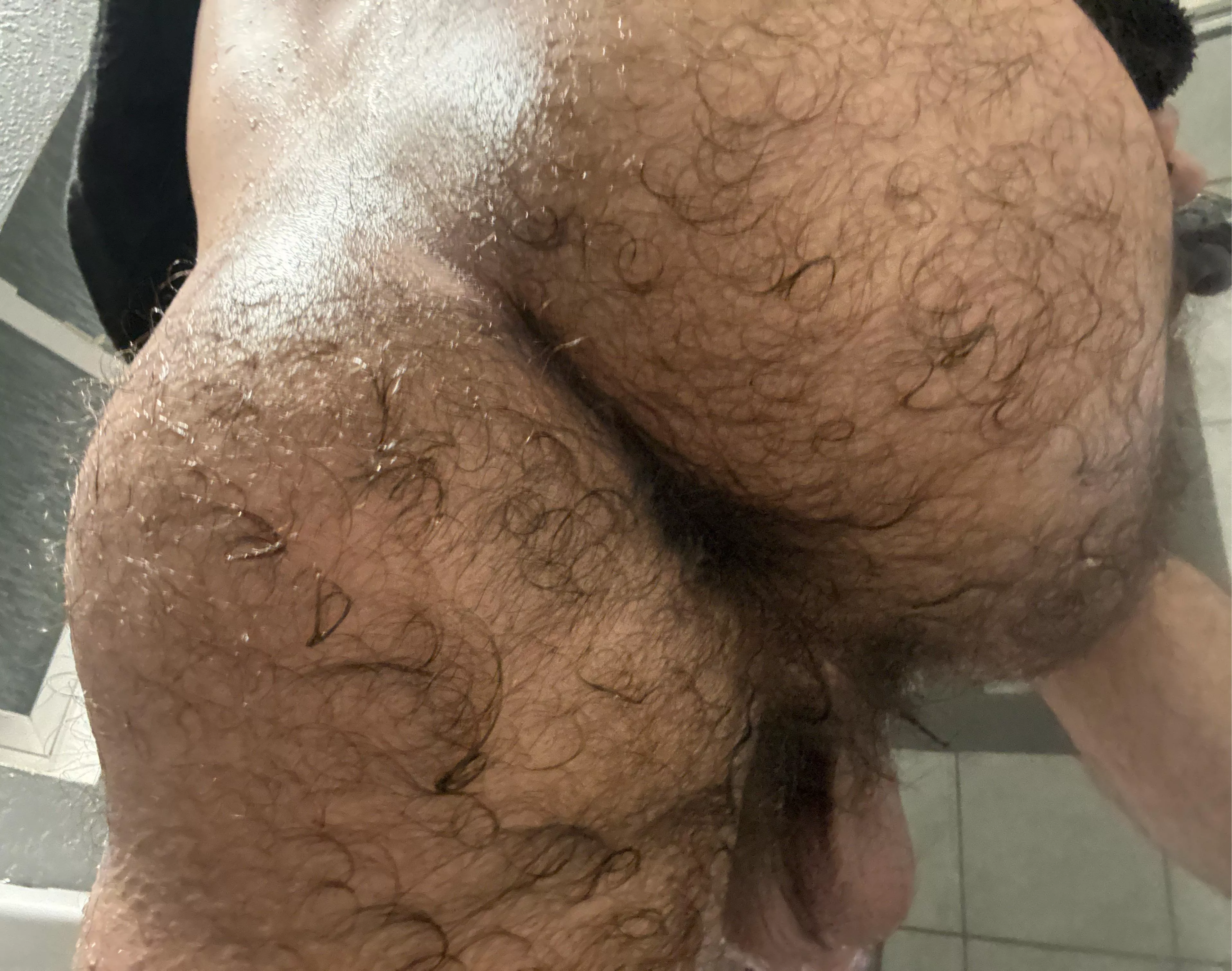 Am I too hairy? (19) posted by Valuable_Bend_6985
