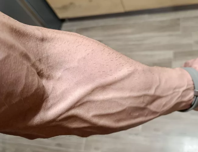 24/7 vascular  by muscletrunks