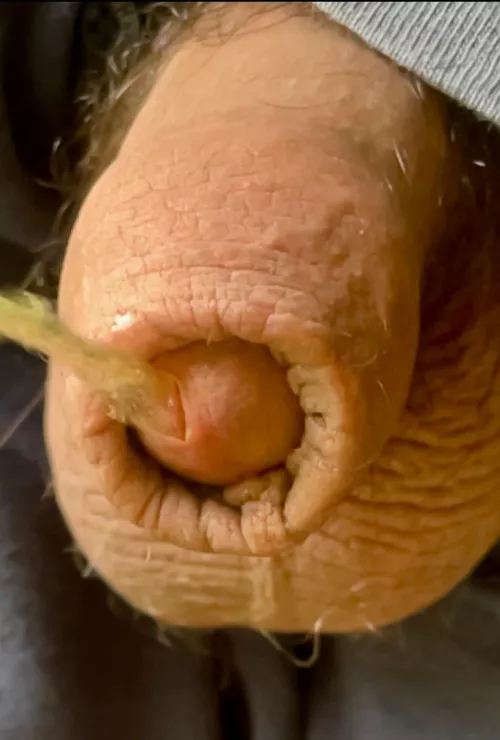 Peeing foreskin by Thrall10