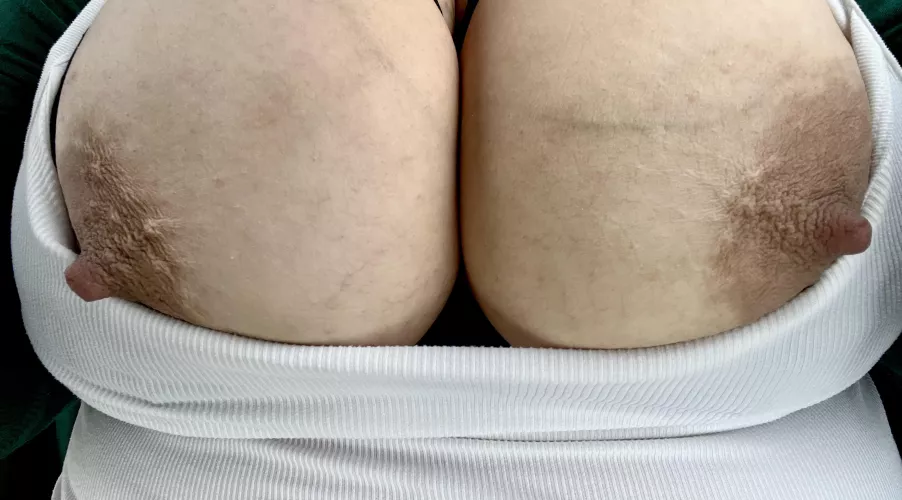 Big veiny tits that need to be sucked by annoymous2025