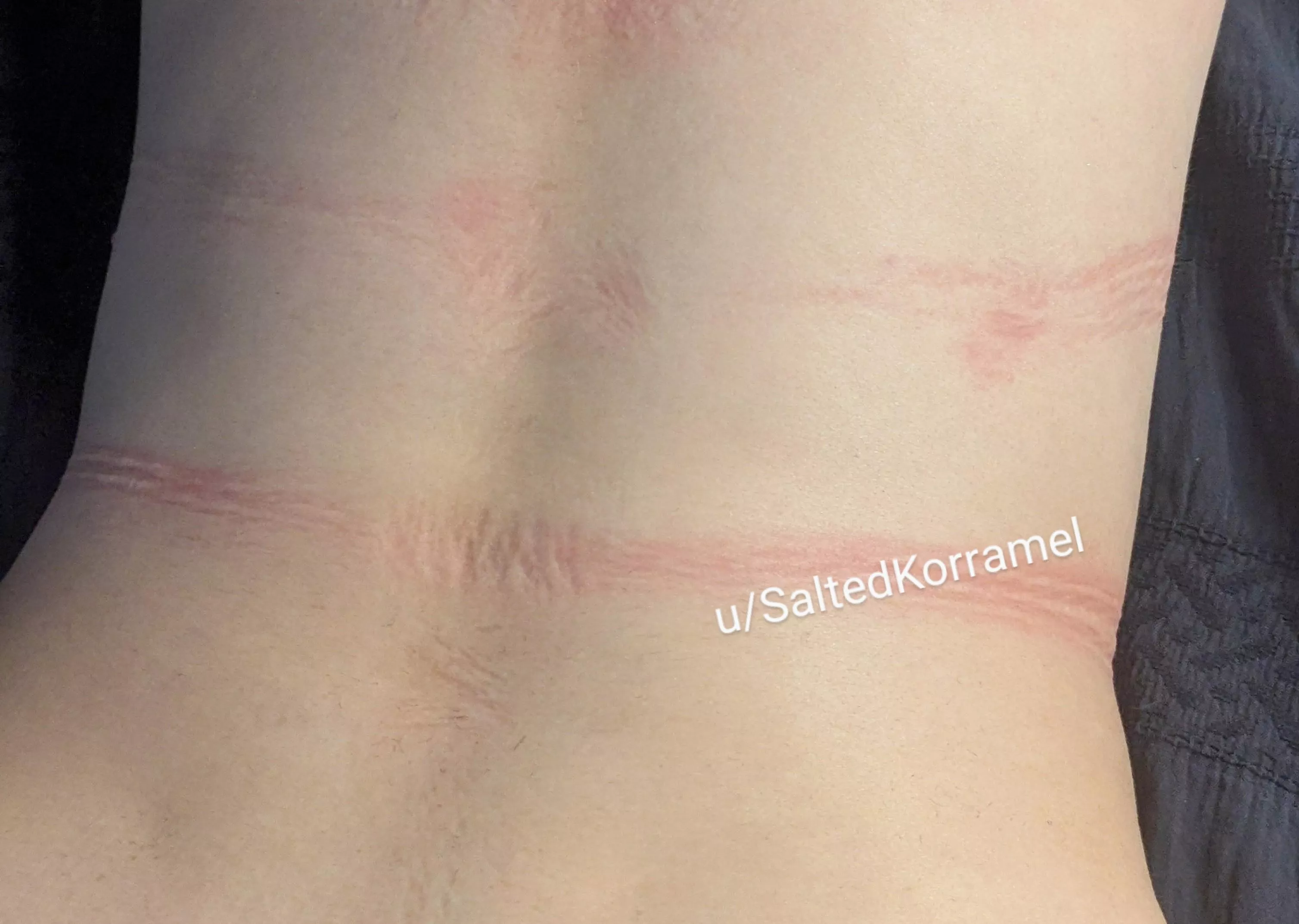 These ropes got my back good posted by SaltedKorramel