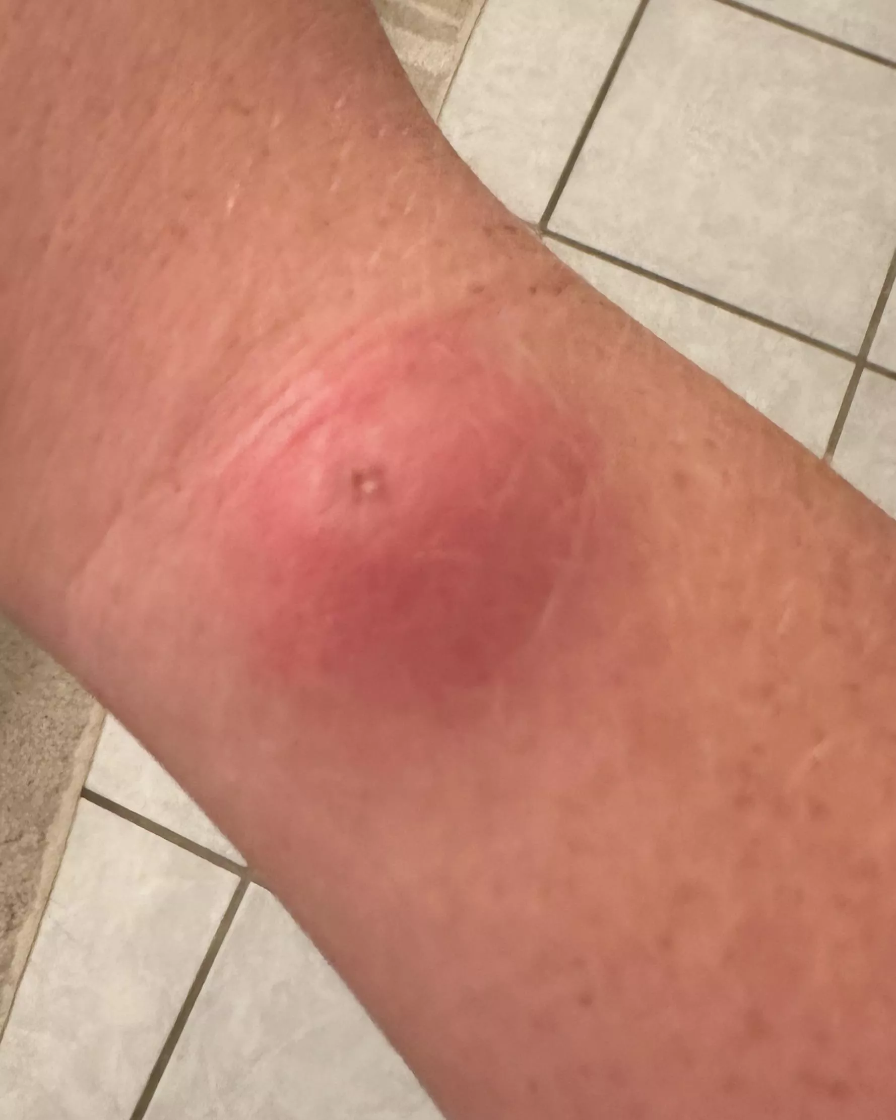 I wish this would pop so bad posted by ResidentAcademic