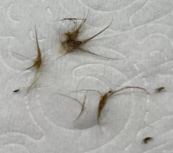 Results of cleaning out my belly button by Past-Sleep-2640