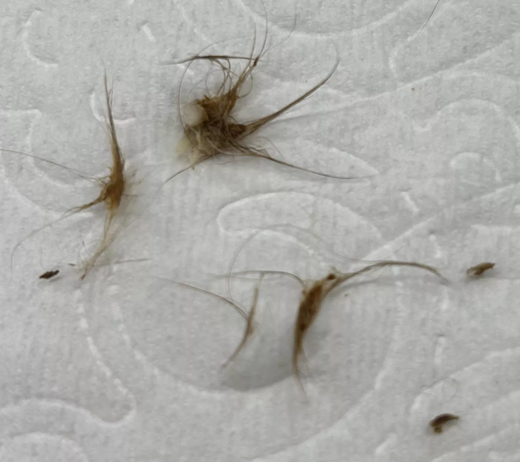 Results of cleaning out my belly button posted by Past-Sleep-2640