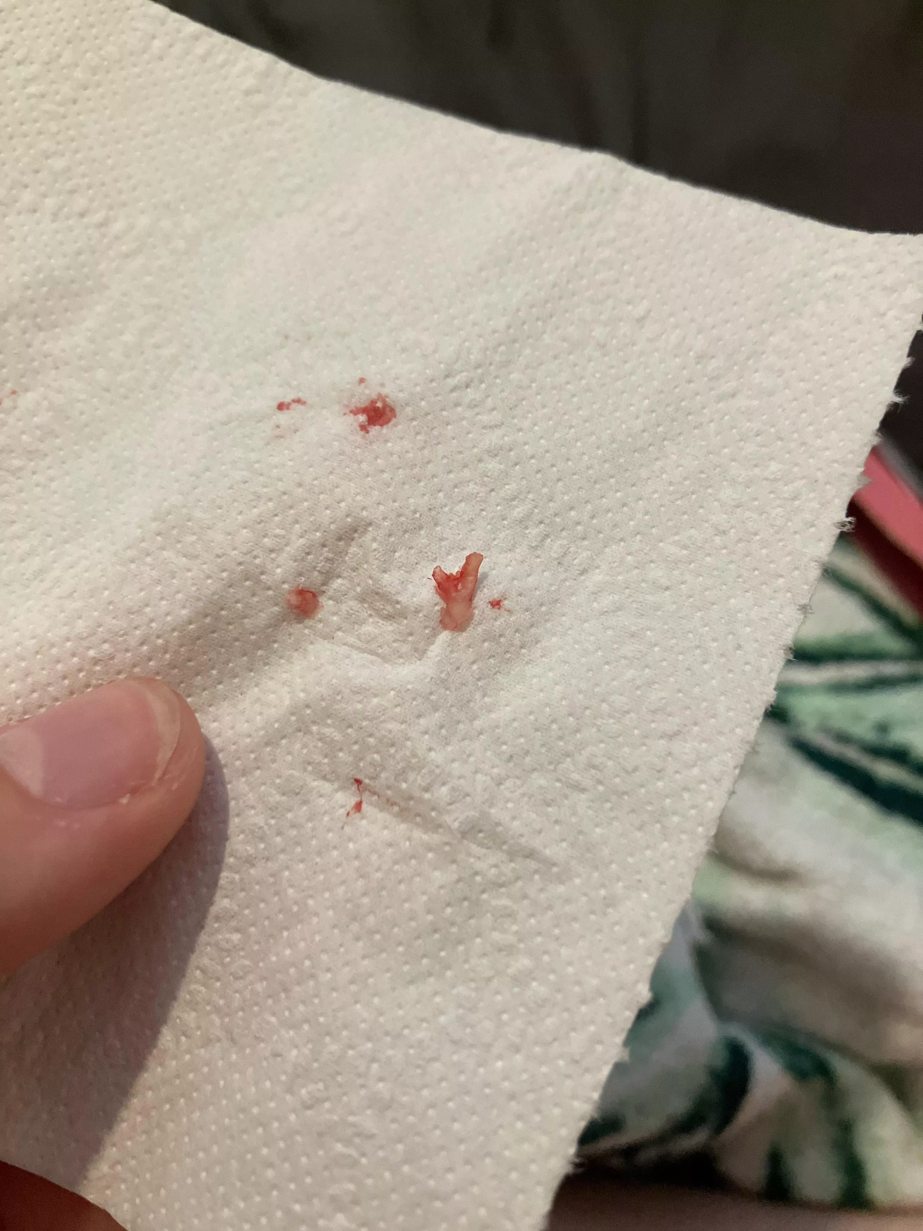 The ingrown toenail I’ve been trying to remove for 3 days! The relief I have now! posted by ImmediateIce675