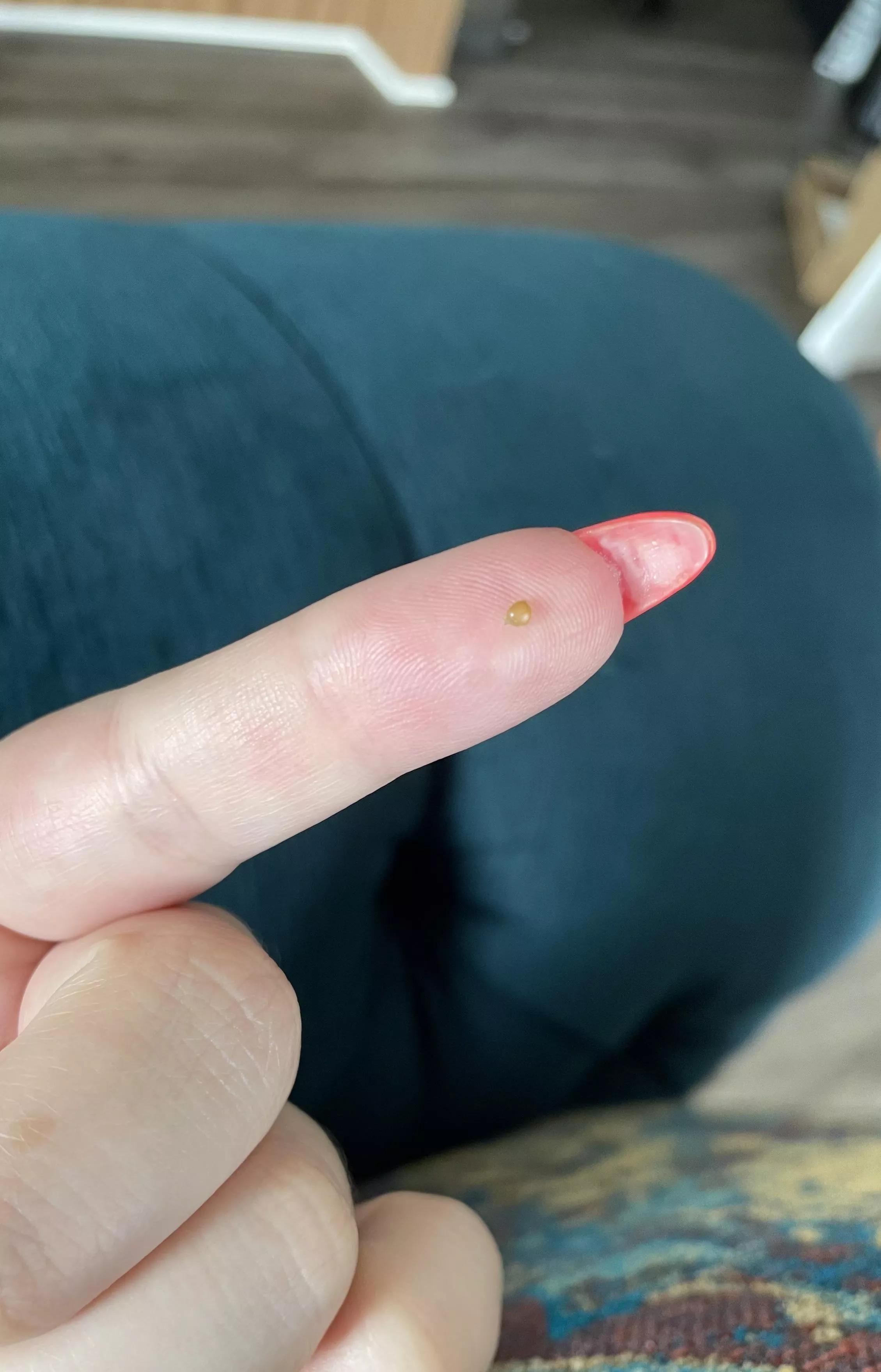 This little pearl popped out of my head today. I dropped it before I could examine further :( posted by mzdameaner