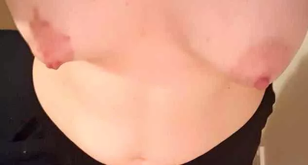 Any other girls with boobs like mine? [27f, 5'4, 120lb] posted by worry-yesterday