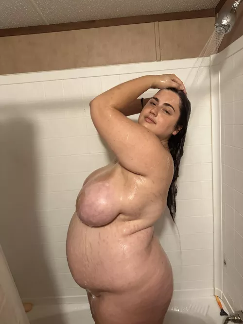 So many stretch marks 🥵 Standing is hard by Busy-Reputation3865