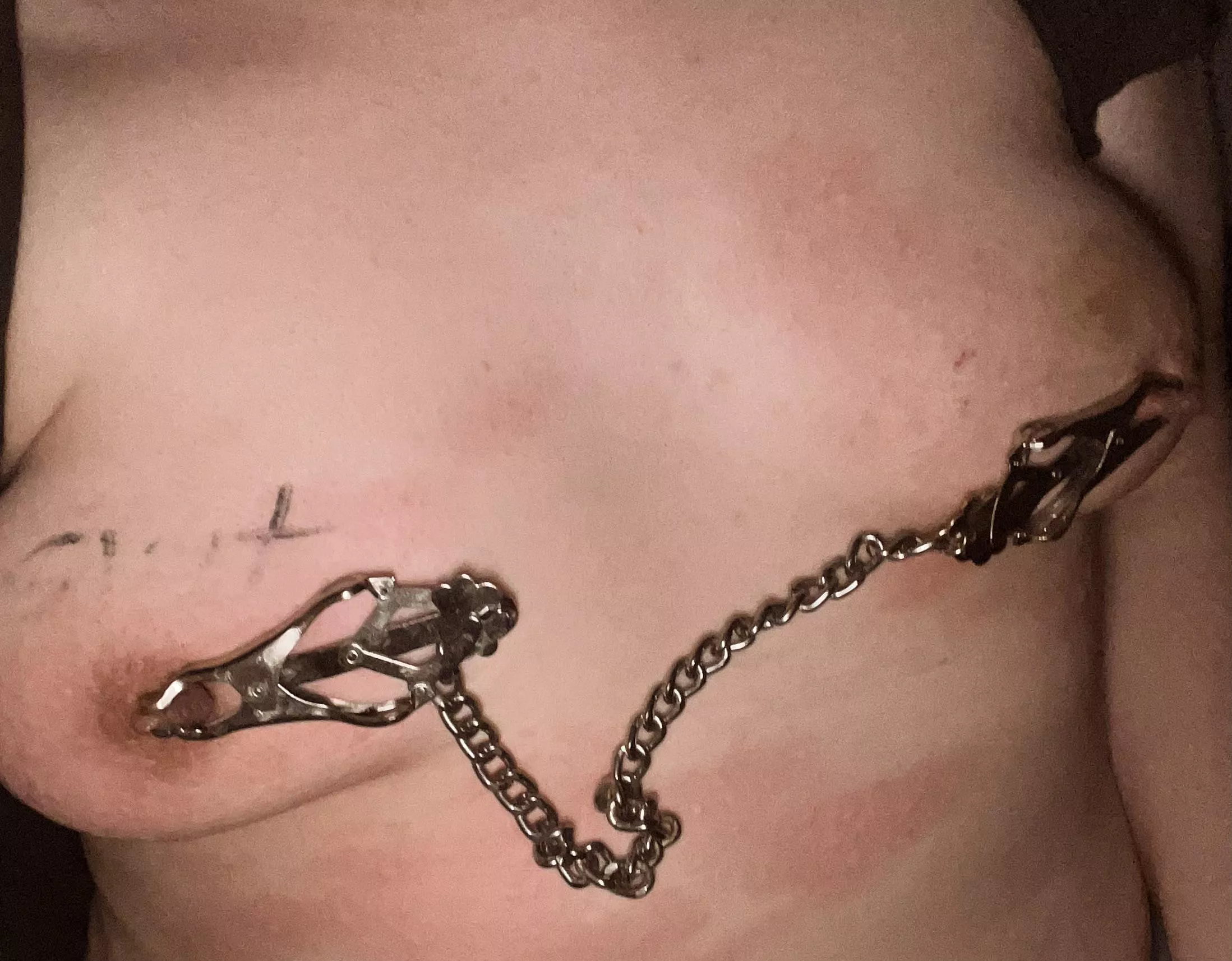 Nettles and Clover Clamps - painful combination  posted by Lanky_Engineering807