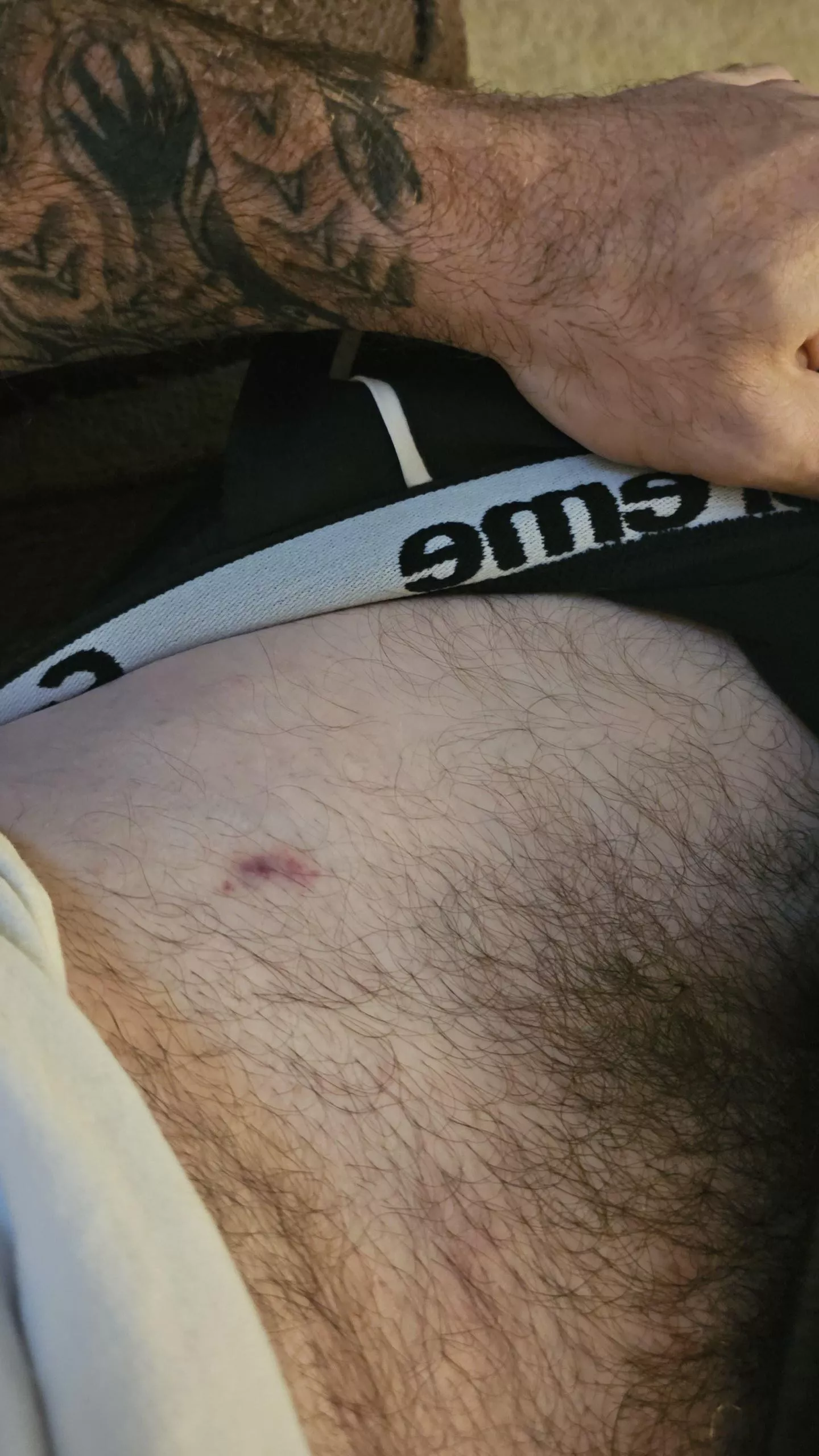 Someone get me a cold spoon. posted by DaddyIssue-Incarnate