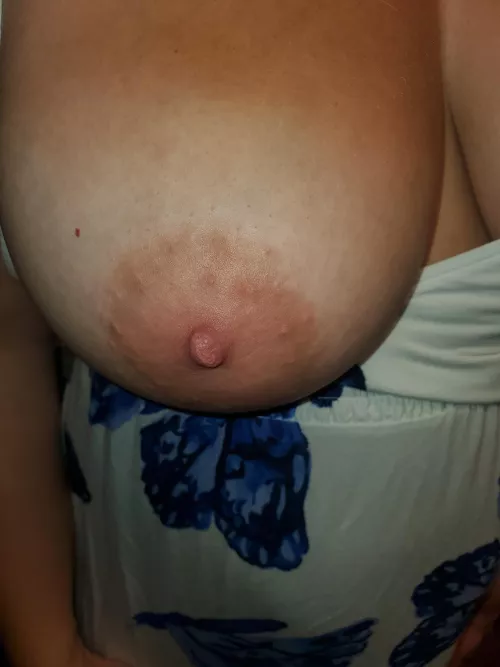 close up🔍 by Professional-Low-46