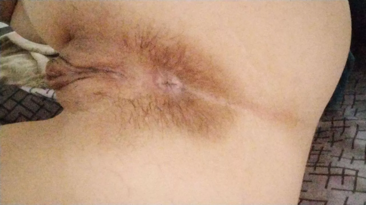 Describe my hairy ass in two words [h] posted by Fun-Occasion-9122