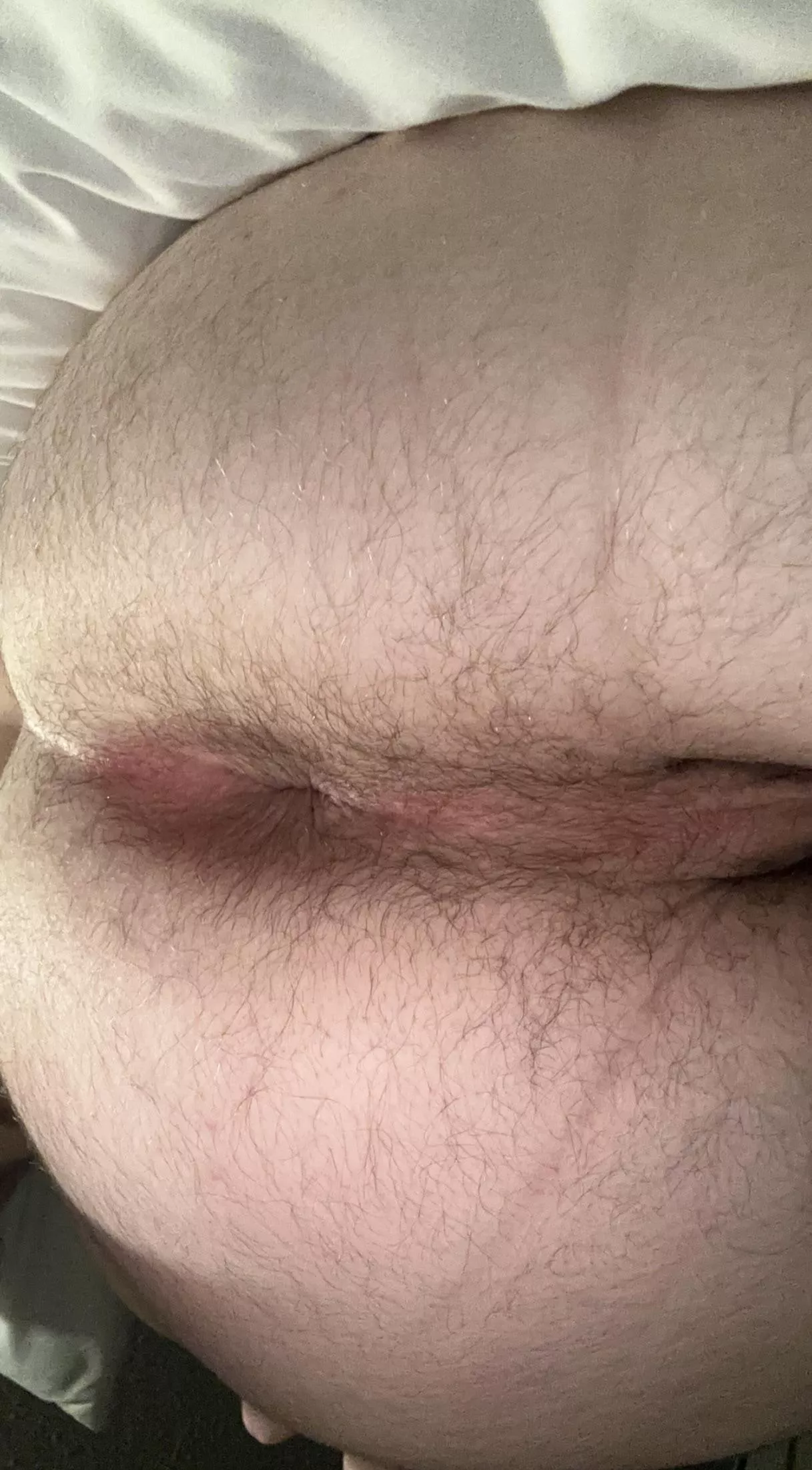 Needs attention (24) posted by Low-Assumption713