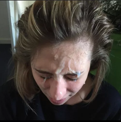 Forehead  by Ok_Flan_3022