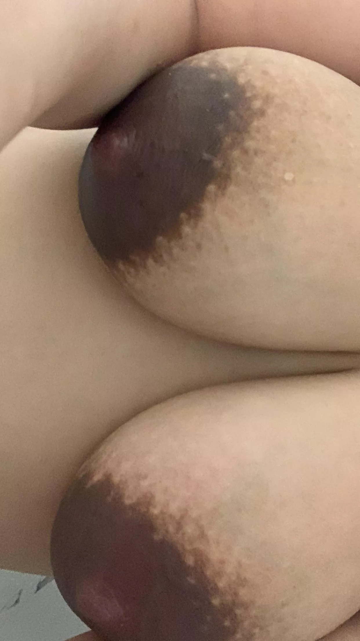 Not nipples got really dark. You still like them?  posted by ghoste2